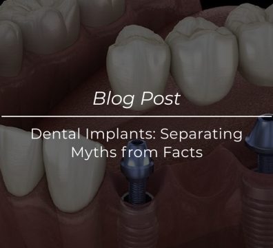 Dental Implants Separating Myths from Facts