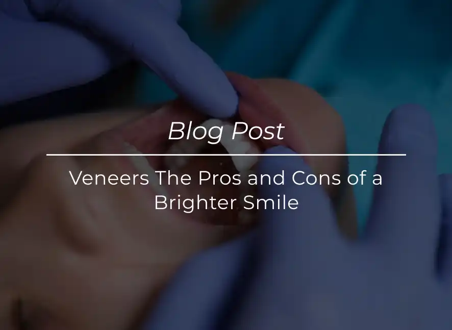 Veneers The Pros and Cons of a Brighter Smile